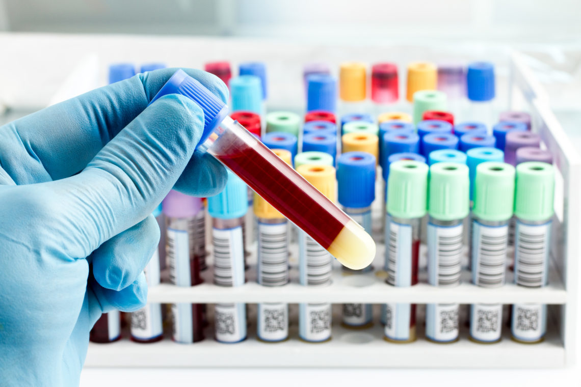 На территории РФ запущено исследование пациентов с заболеваниями крови и коронавирусной инфекцией