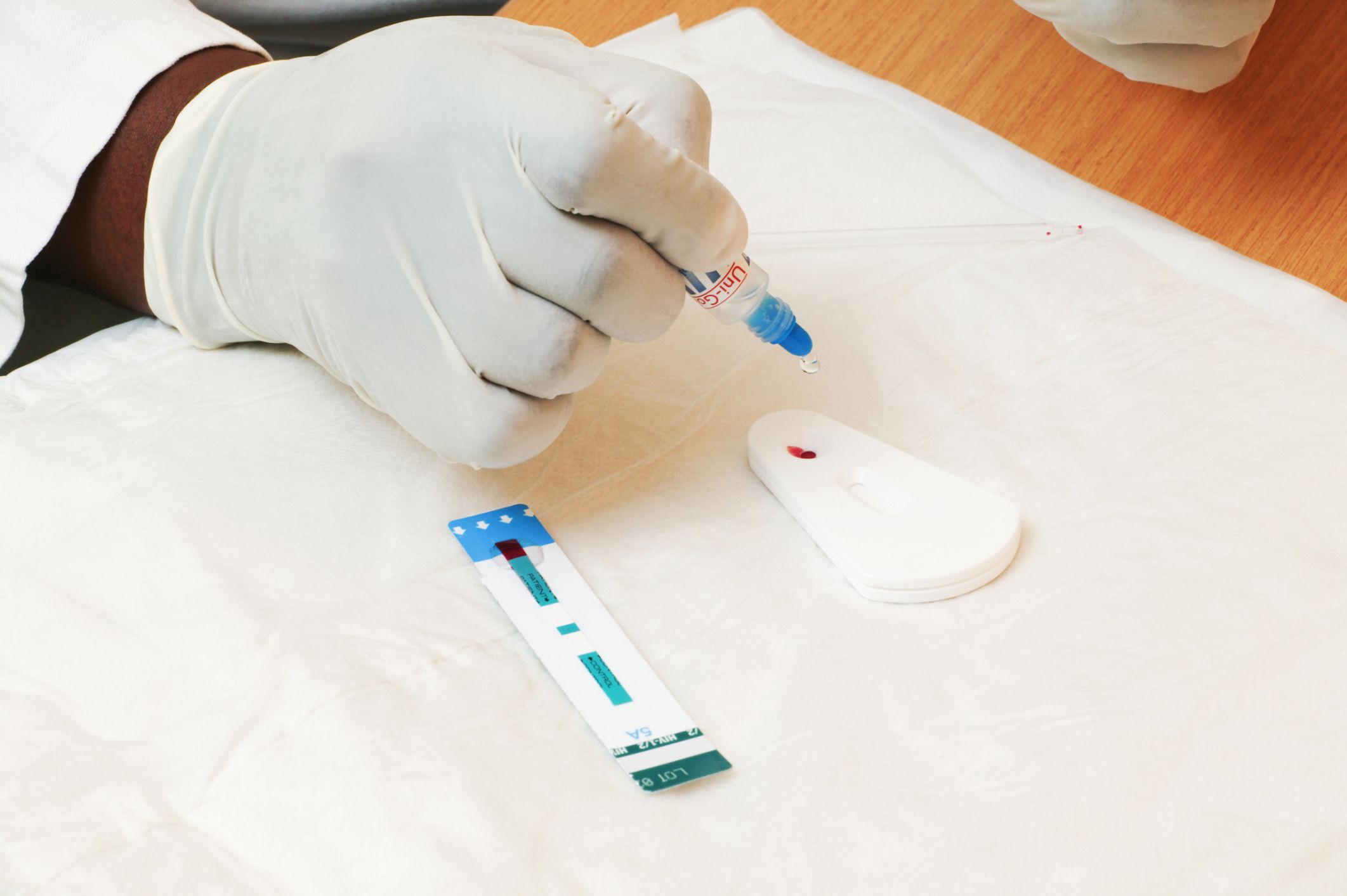 В НИИ эпидемиологии заявили о готовности наращивать выпуск тестов для диагностики ВИЧ
