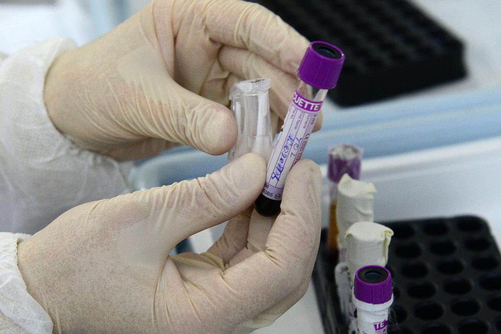 Министерство здравоохранения планирует запустить производство тест-систем для диагностики COVID-19