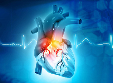 Эффективно снизить риск развития осложнений при фибрилляции предсердий позволяет ранний контроль сердечного ритма